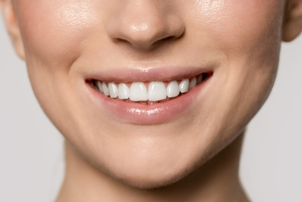 Whiten Teeth In Troy NY
