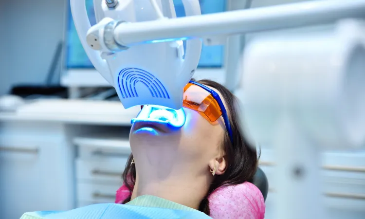 The Truth About Teeth Whitening Trends in Troy, NY